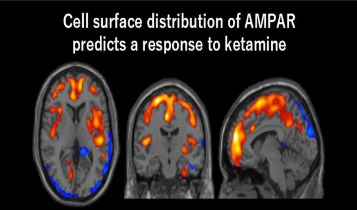 This shows PET scan images of the brain in response to ketamine.