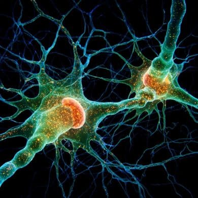 This shows neurons.