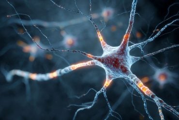 This shows a neuron.