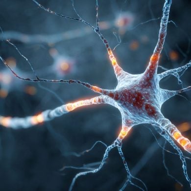 This shows a neuron.