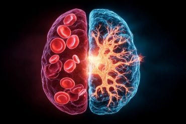 This shows a brain and sickle cells.