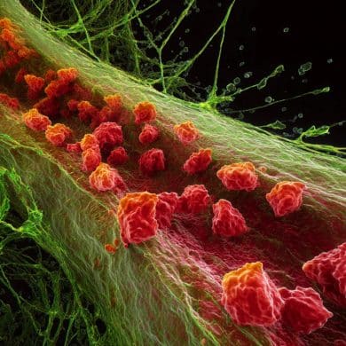 This image represents the Tau clearing process.