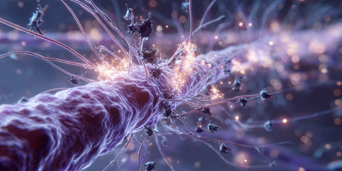 This shows a neuron.