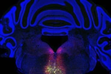 This brain slice shows the RVM.