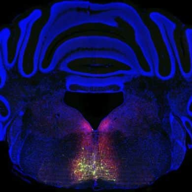 This brain slice shows the RVM.