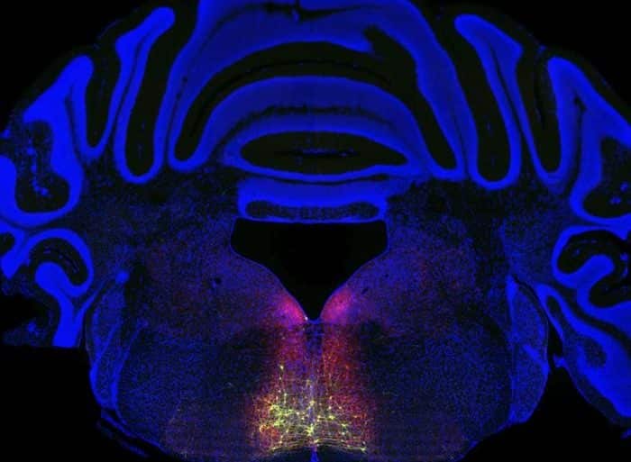 This brain slice shows the RVM.