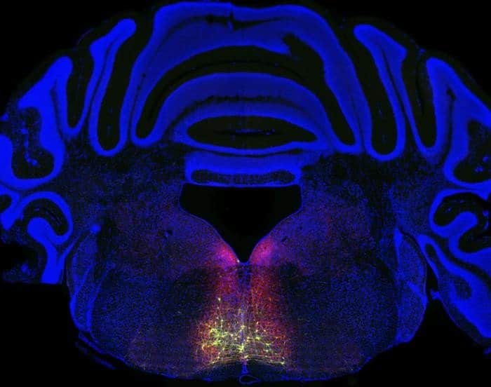 This brain slice shows the RVM.