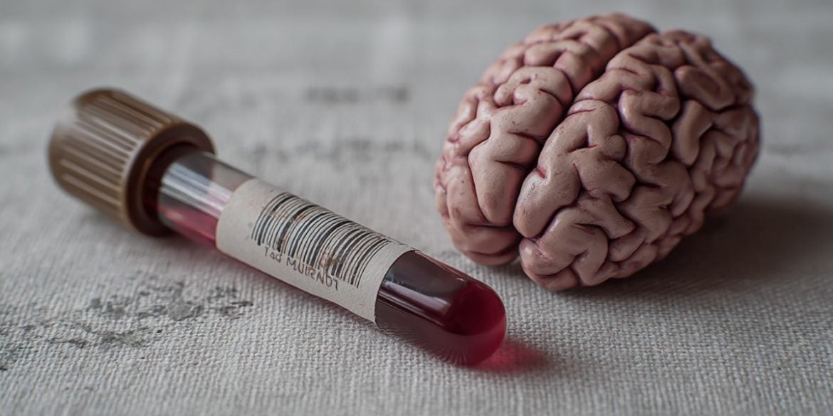 This shows a brain and a blood vial.