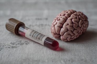 This shows a brain and a blood vial.