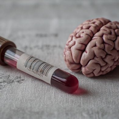 This shows a brain and a blood vial.