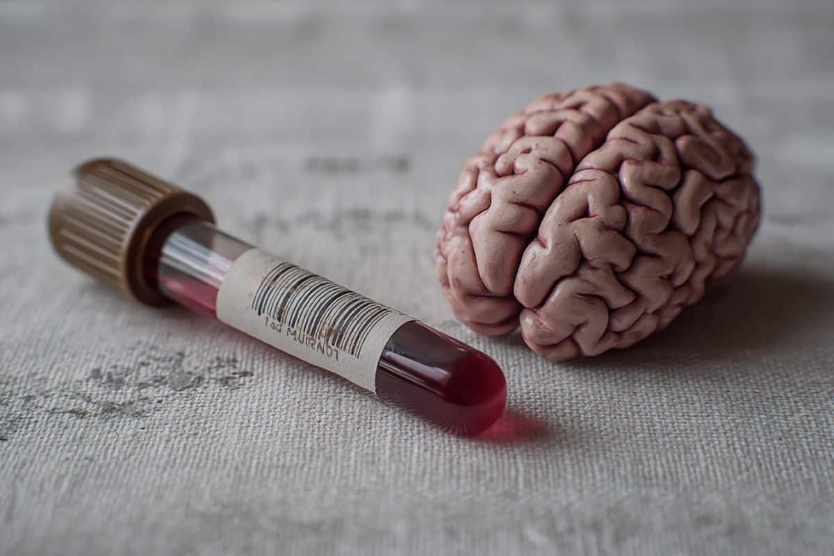 This shows a brain and a blood vial.