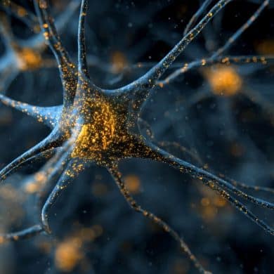 This shows an astrocyte.