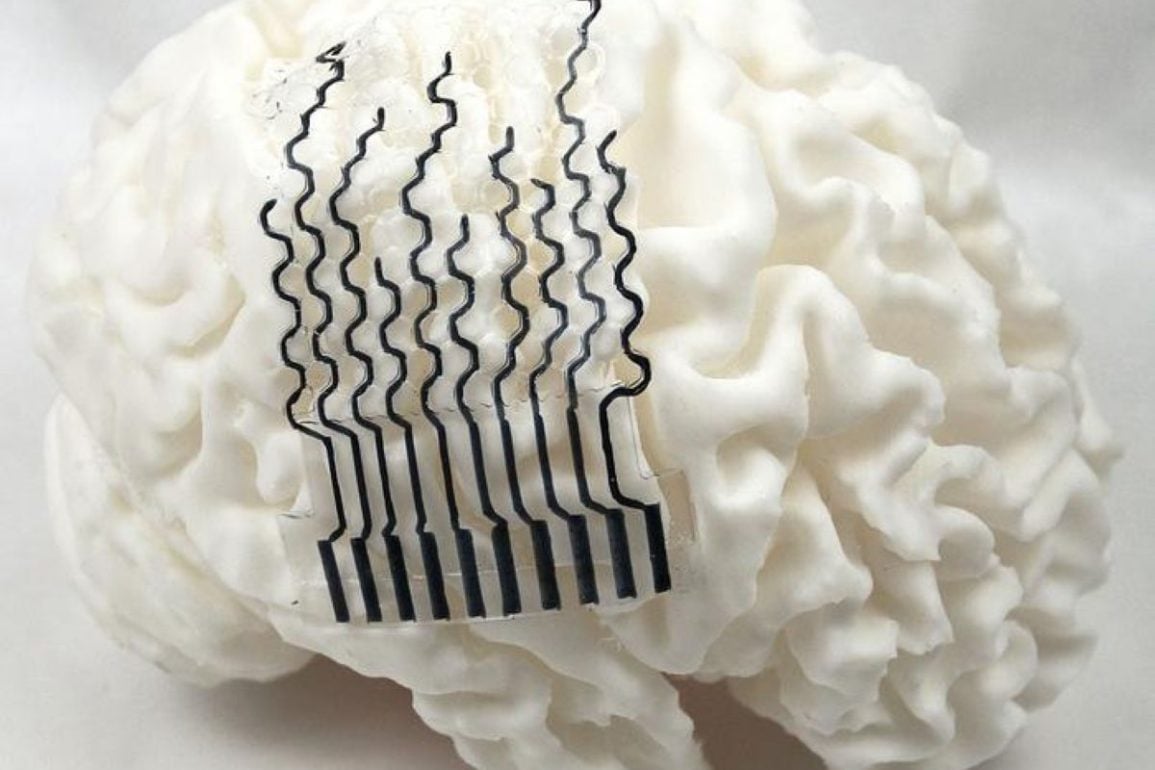 3D-Printed “Honeycomb” Sensors Match Your Unique Neural Map