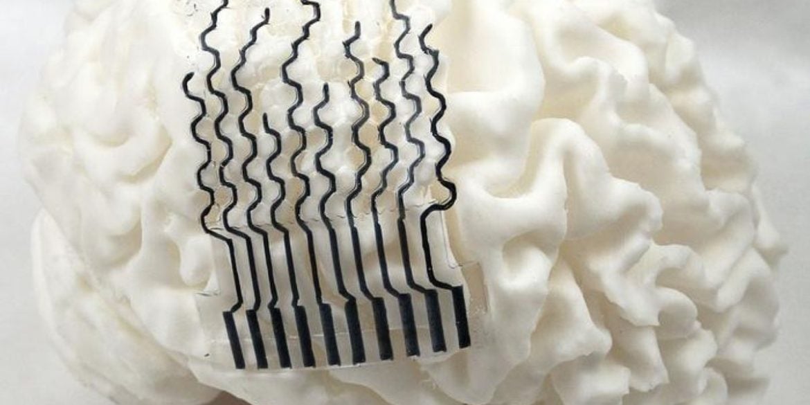 This shows a brain model with the bci on it.