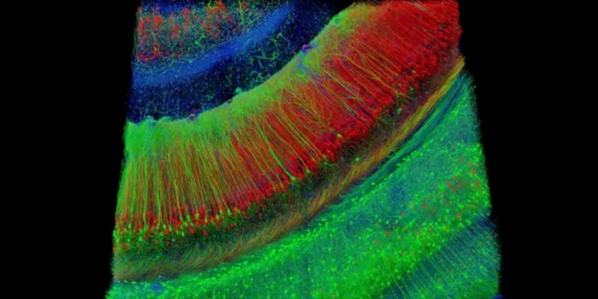 This shows a hippocampal brain slice.