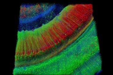 This shows a hippocampal brain slice.