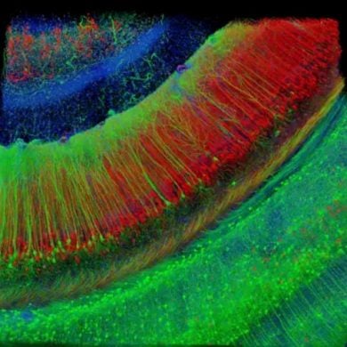 This shows a hippocampal brain slice.
