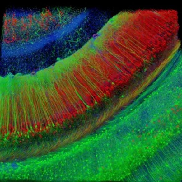 This shows a hippocampal brain slice.
