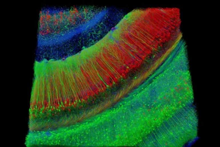 This shows a hippocampal brain slice.