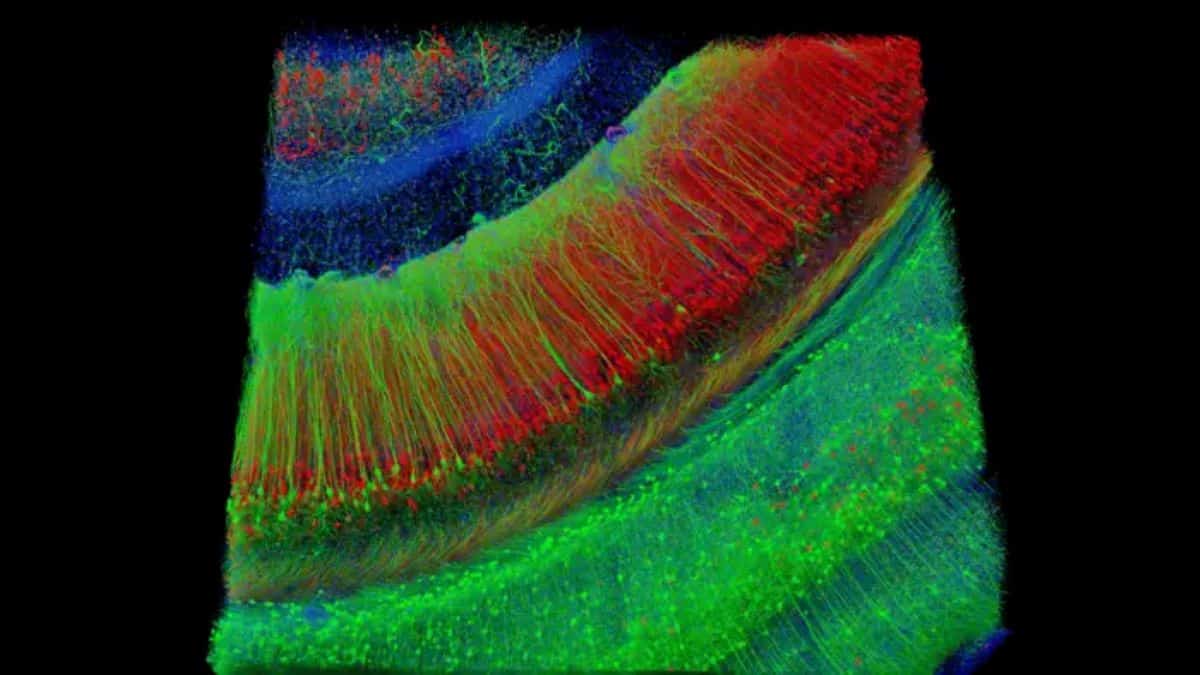 This shows a hippocampal brain slice.