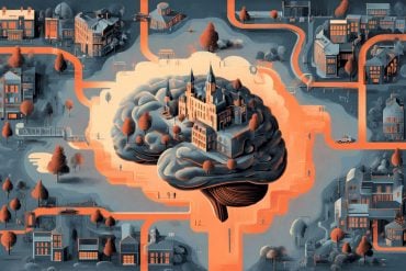 This shows a brain surrounded by buildings and a road.