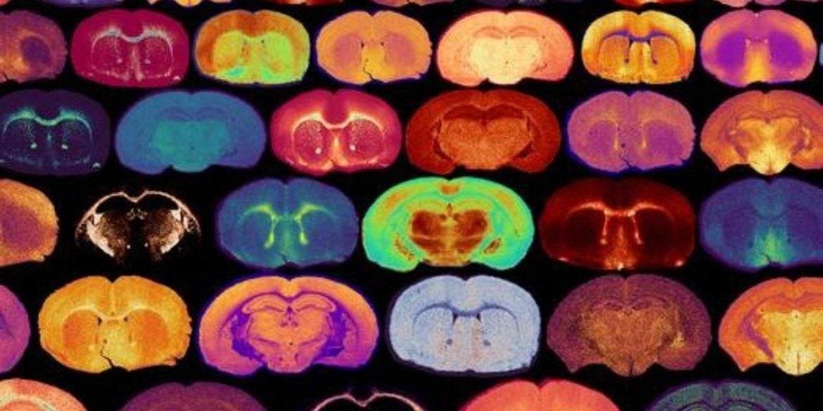 This shows brain slices.