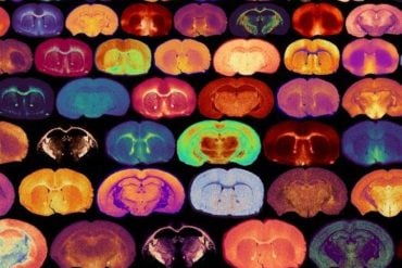 This shows brain slices.