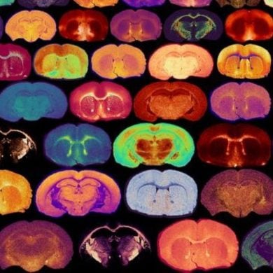 This shows brain slices.