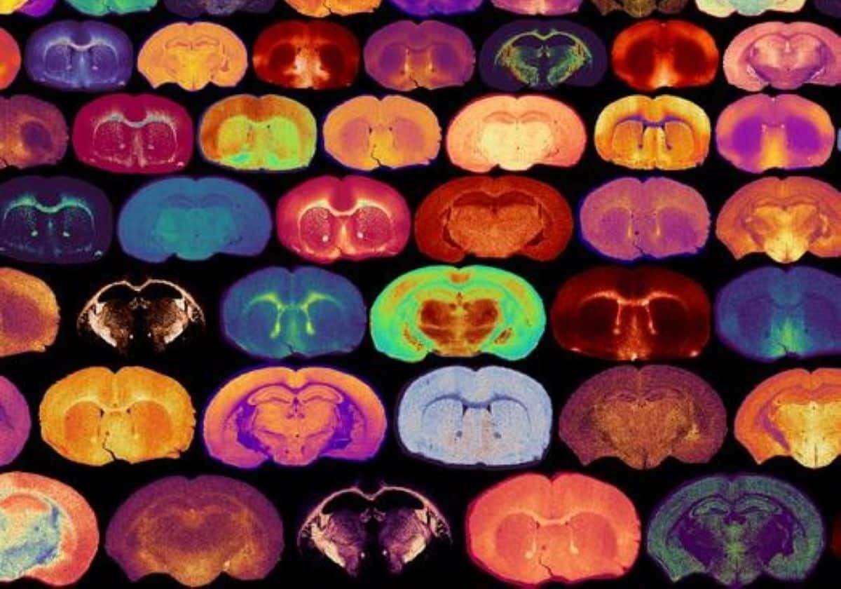 This shows brain slices.