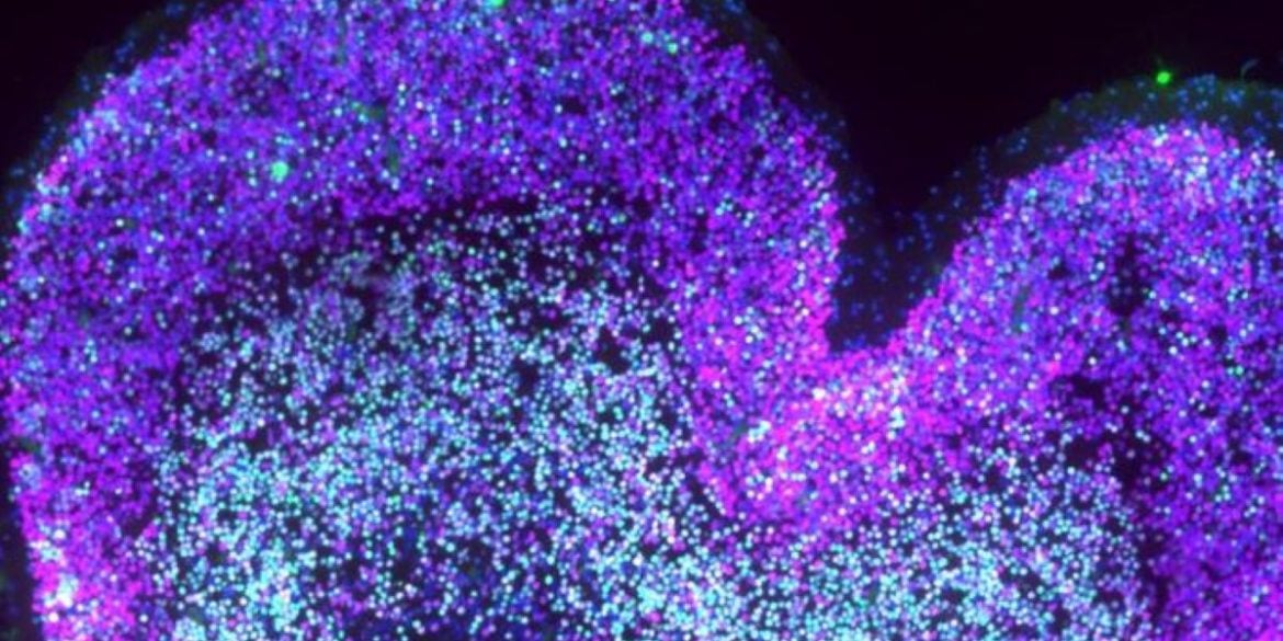 This shows neurons in the developing neocortex.