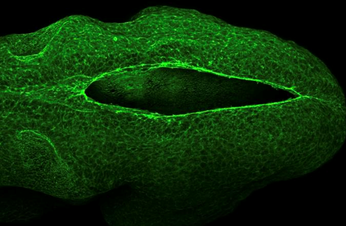 Cellular Drawstrings Seal the Developing Brain