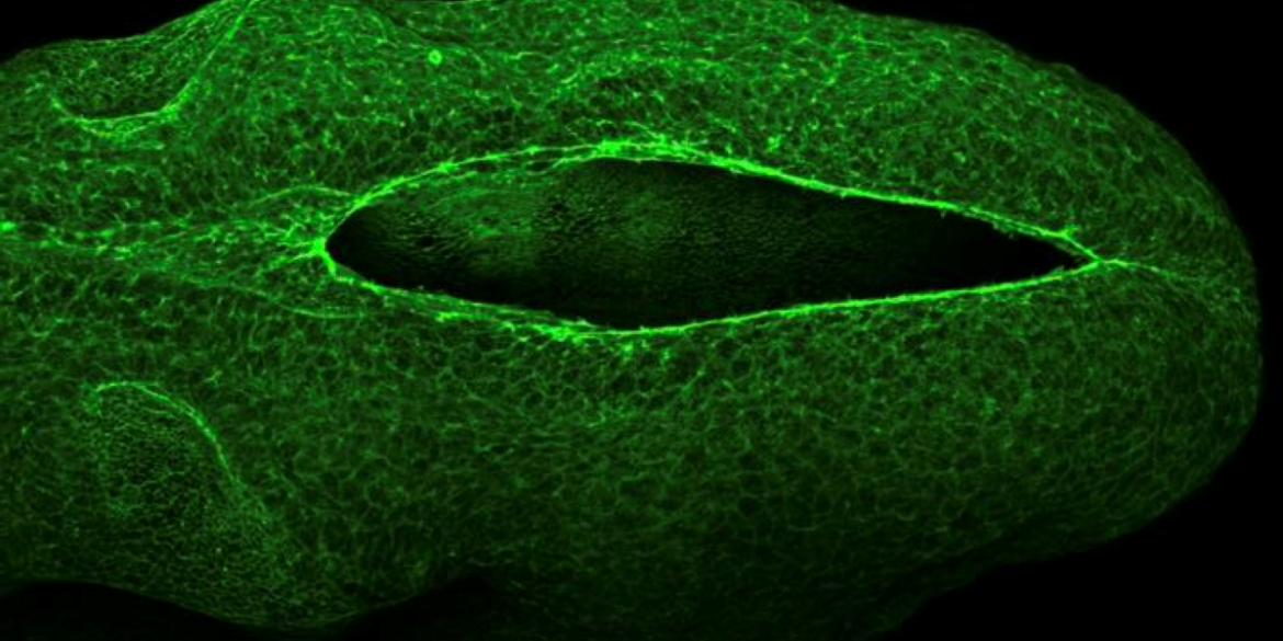 This shows a neural tube.