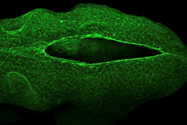 This shows a neural tube.