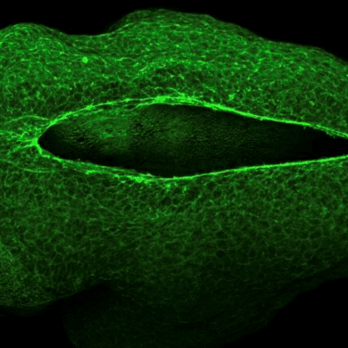 This shows a neural tube.