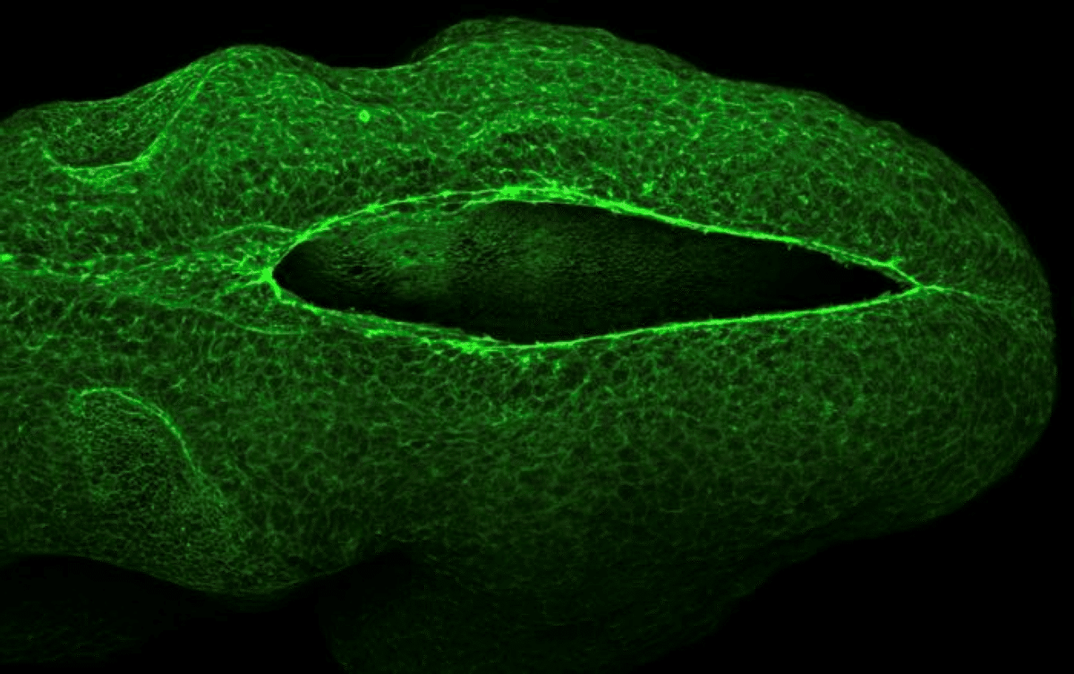 Cellular Drawstrings Seal the Developing Brain