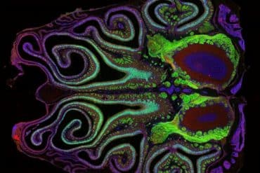 This shows a brain scan of the olfactory system in mice.