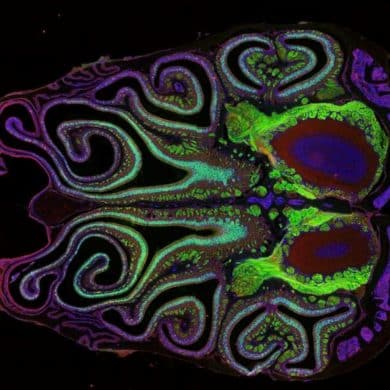 This shows a brain scan of the olfactory system in mice.