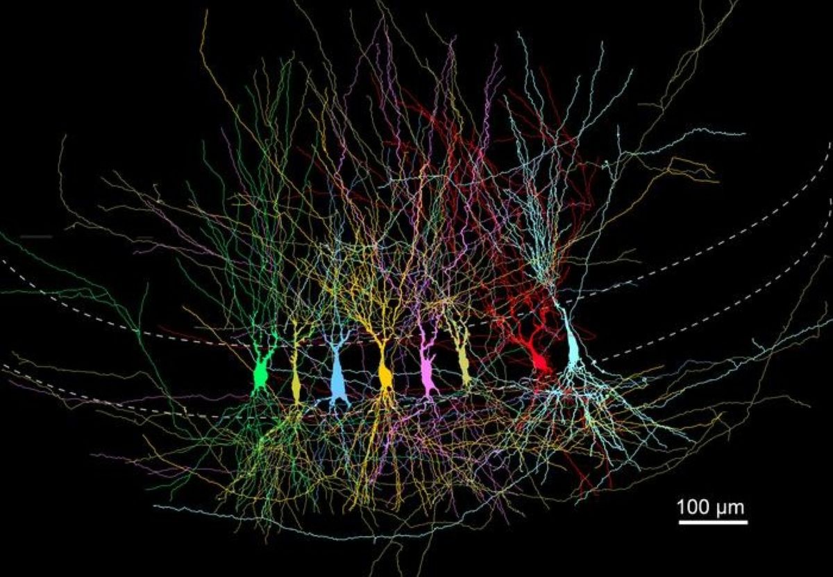 Why the Brain Starts with “Too Much” to Build Memories