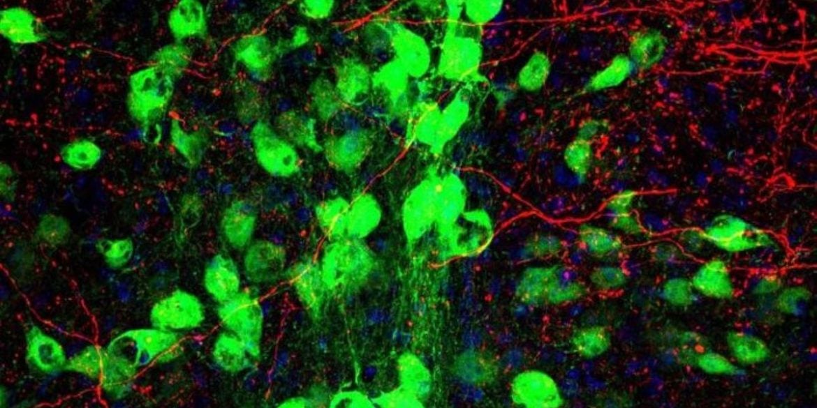 This shows motor neurons.