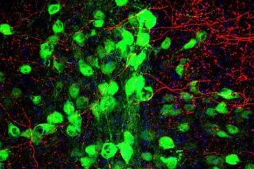 This shows motor neurons.