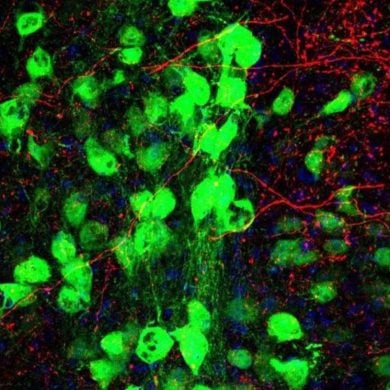 This shows motor neurons.