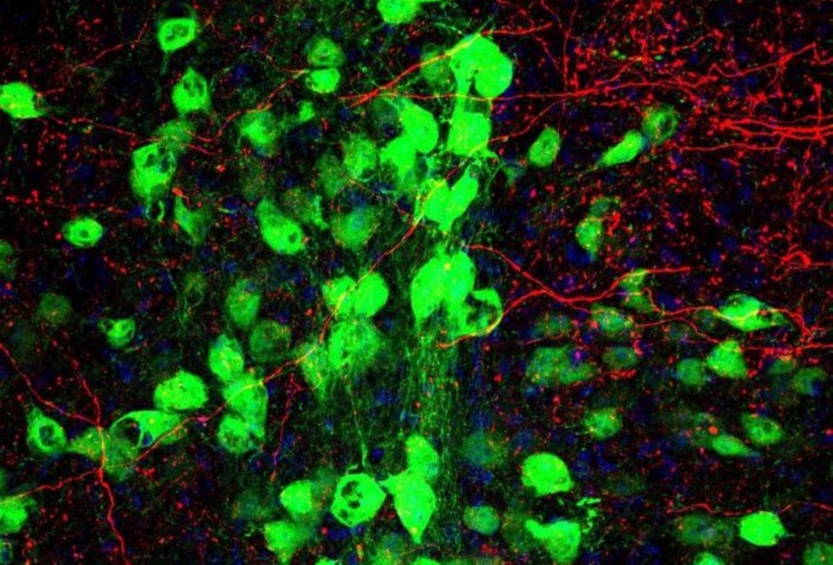 Tourette’s and OCD Share a Common Neural Pathway