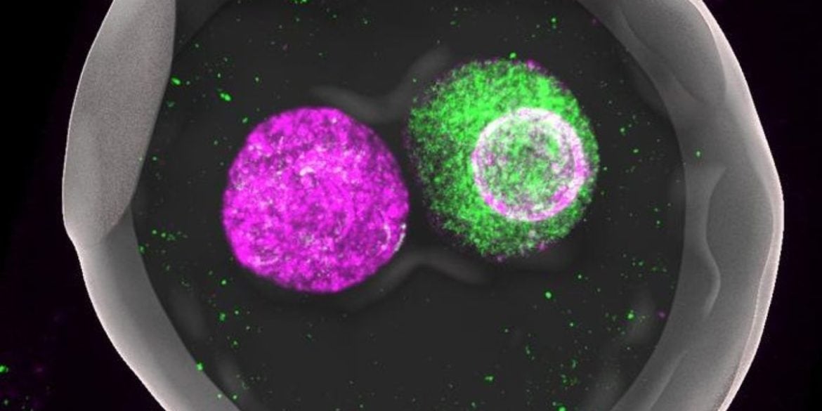 This shows a zygote.