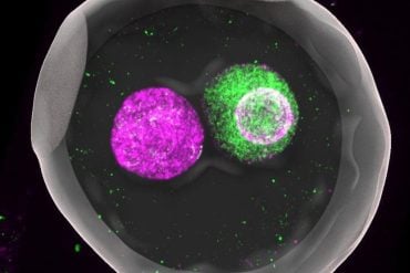 This shows a zygote.