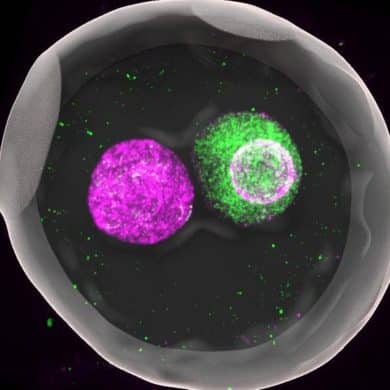 This shows a zygote.