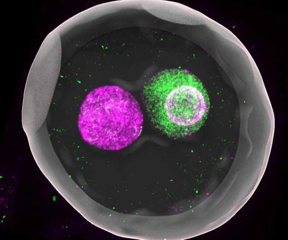 This shows a zygote.