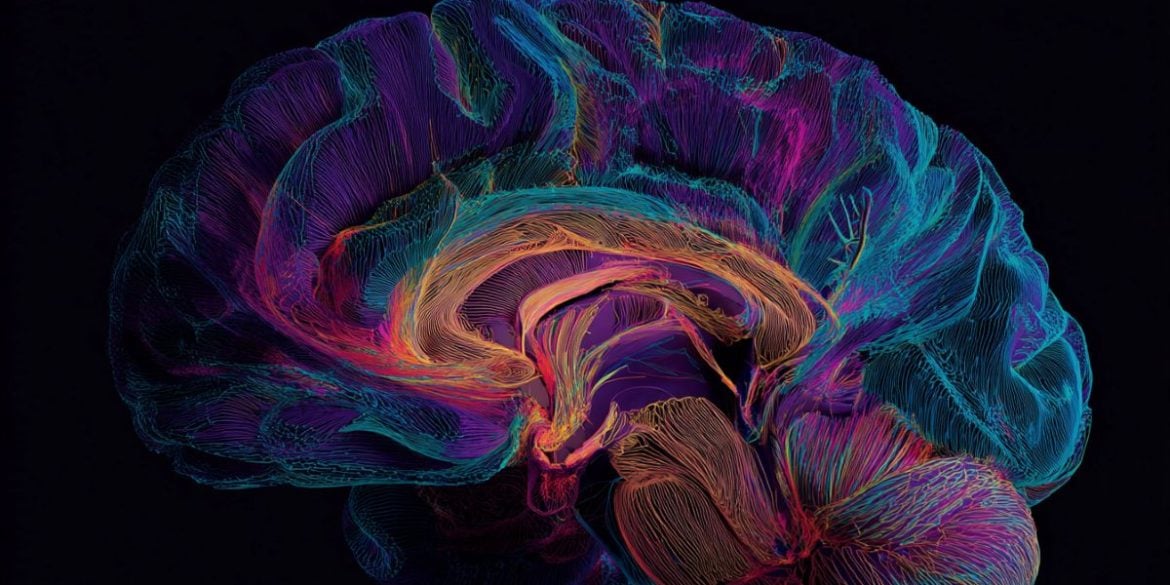 This shows a brain.