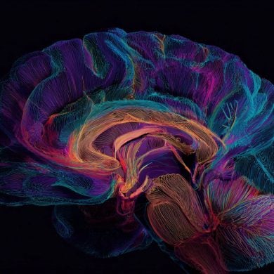 This shows a brain.