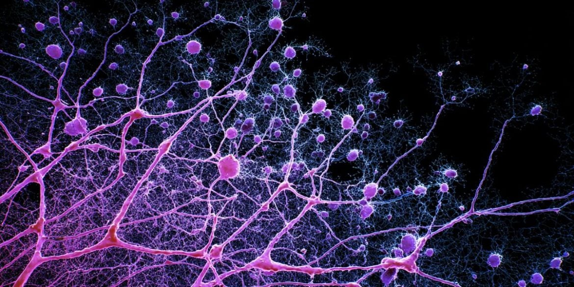 This shows neurons.