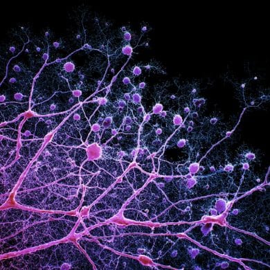 This shows neurons.